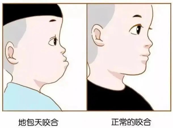 地包天534768349835794.jpg